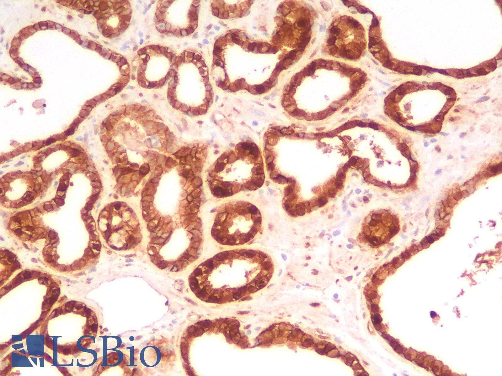 PathPlus™ CTNNB1 / Beta Catenin Antibody (clone CTNNB1/2030R)