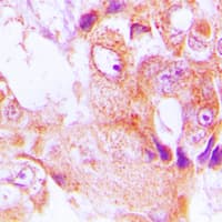 Polyclonal Rabbit anti-Human EPHX3 / Epoxide Hydrolase 3 Antibody (Internal, IHC, WB)