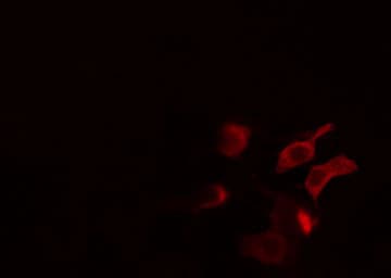 CLCN4 / CLC-4 Antibody