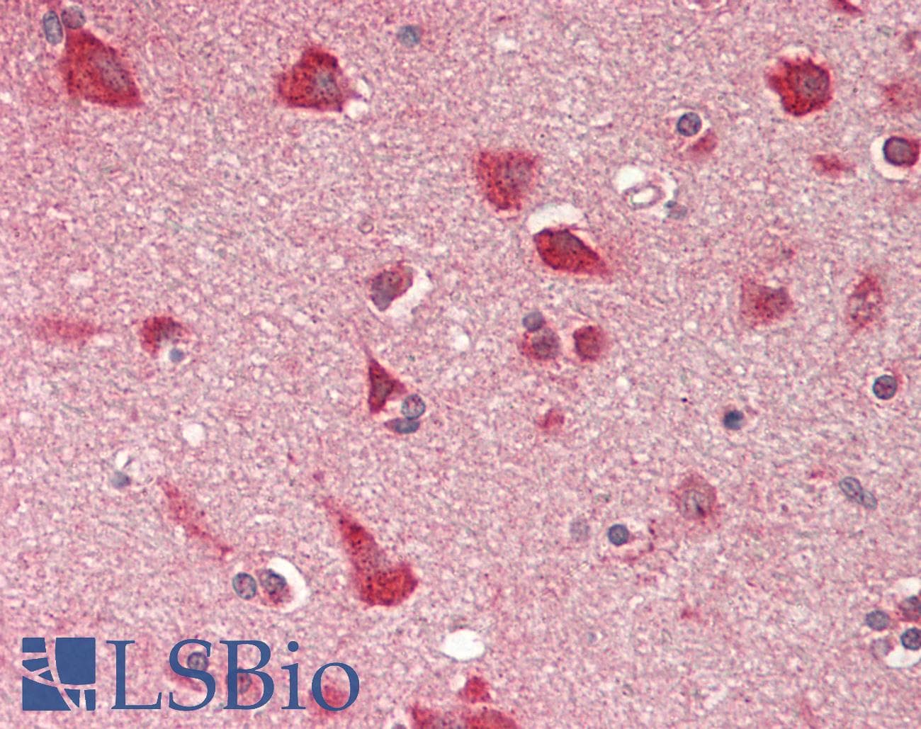 IHC-plus™ NINJ1 / Ninjurin Antibody