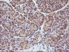 MEF2C Antibody (clone OTI1B6)