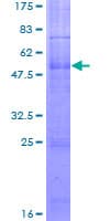 Human MC2R / ACTHR / ACTH Receptor Protein (Recombinant GST)