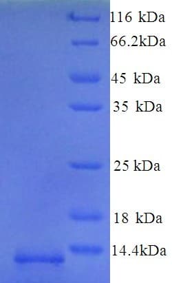 Mouse GUCA2B / Uroguanylin Protein (Recombinant His)