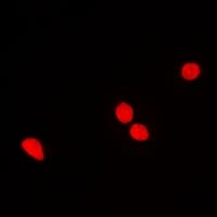 RNGTT / HCAP Antibody