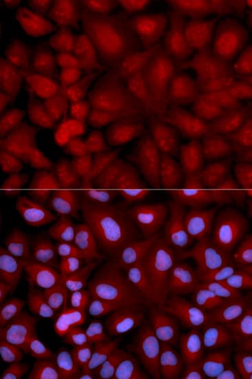 IHC-plus™ SNCG / Gamma-Synuclein Antibody