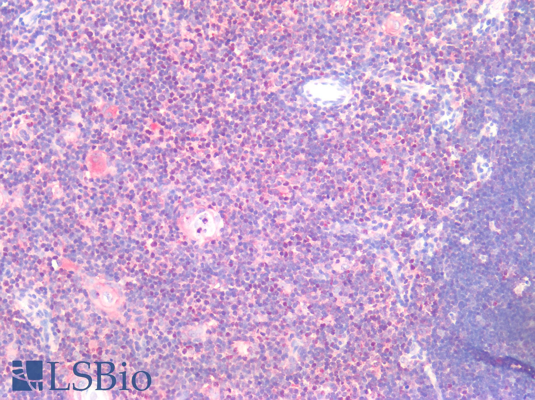 PathPlus™ Monoclonal Mouse anti-Human CD71 / Transferrin Receptor Antibody (clone H68.4, aa3-28, IHC, IF, WB)