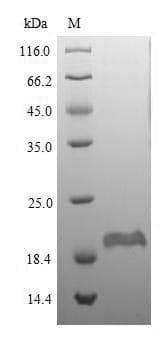 Mouse DEFB1 / BD-1 Protein (Recombinant 6His-SUMO, N-terminus)