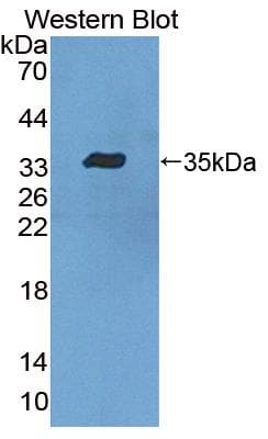 LSP1 Antibody (aa126-330, HRP)