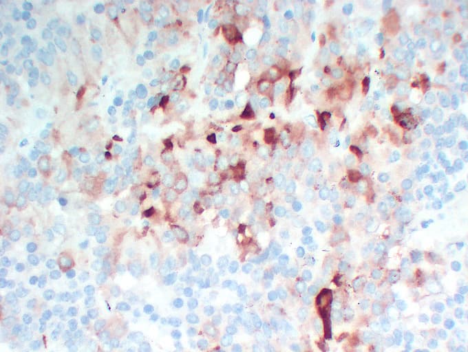 FSHB / FSH Beta Antibody (clone ABT-FSH)