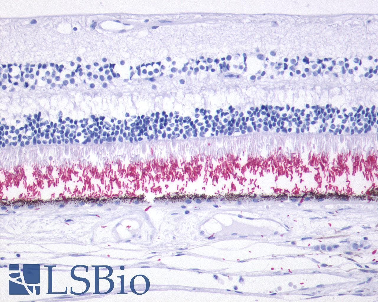 PathPlus™ Polyclonal Rabbit anti-Human Rhodopsin / RHO Antibody (Extracellular Domain, IHC)