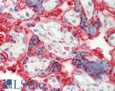 IHC-plus™ HSP90B1 / GP96 / GRP94 Antibody (aa754-803)