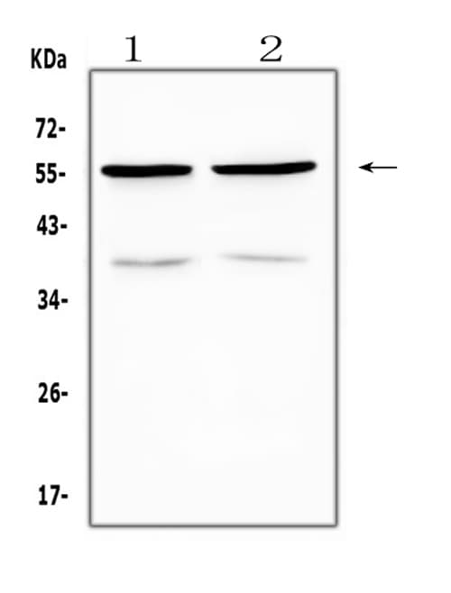 Polyclonal Rabbit anti-Human PTP1B Antibody (IHC, WB)