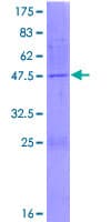 Human NME4 Protein (Recombinant GST)