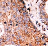 KPI-2 / LMTK2 Antibody (aa70-100)