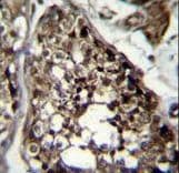 TBCEL / E-Like Antibody (aa385-413)