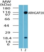 ARHGAP20 Antibody (aa570-620)