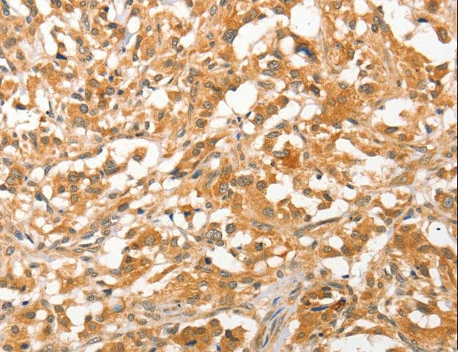 Aprataxin / APTX Antibody