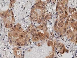 DNAJA2 Antibody (clone OTI1G3)