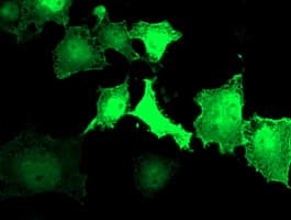 ARH / LDLRAP1 Antibody (clone OTI2B2)