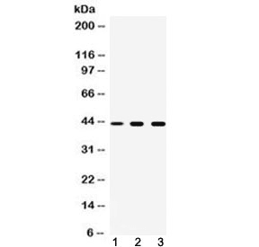 Tyrosine Aminotransferase Antibody