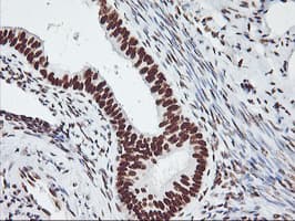 GSTT2 Antibody (clone OTI6C4)