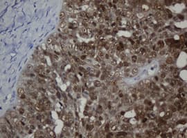 MGMT Antibody (clone OTI1B12)