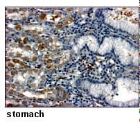 Polyclonal Rabbit anti-Human SLC2A1 / GLUT-1 Antibody (IHC, WB)