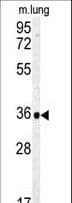 CA4 / Carbonic Anhydrase IV Antibody (aa243-272)