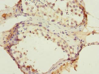 ANTXR2 / CMG2 Antibody