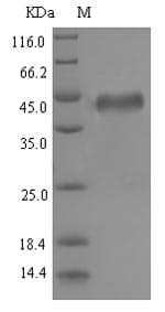 Epstein-Barr Virus gB Protein (Recombinant 6His-SUMO, N-terminus)