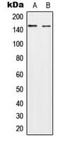 IHC-plus™ Polyclonal Rabbit anti-Human NEDL2 / HECW2 Antibody (Internal, IHC, IF, WB)