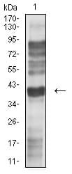 CCR5 Antibody (clone 6H3D5)