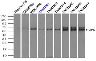 LIPG / Endothelial Lipase Antibody (clone OTI2H10)
