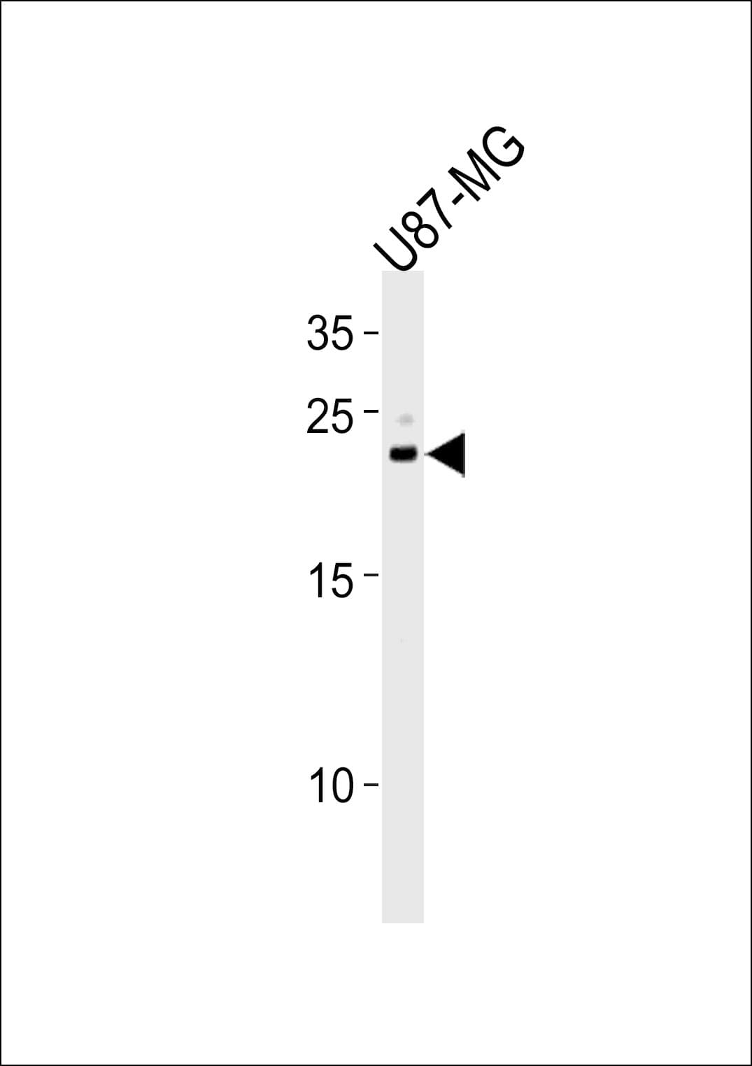 CNTF Antibody (aa114-140)