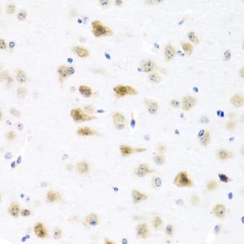 C8orf4 Antibody