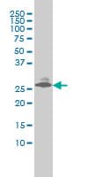 IHC-plus™ Monoclonal Mouse anti-Human Endothelin 3 / EDN3 Antibody (clone 2A6-2A4, IHC, WB)