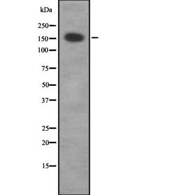 CDC42BPG Antibody