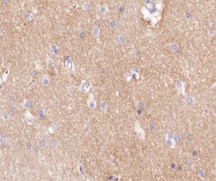 F8 / FVIII / Factor VIII Antibody (aa2187-2209)