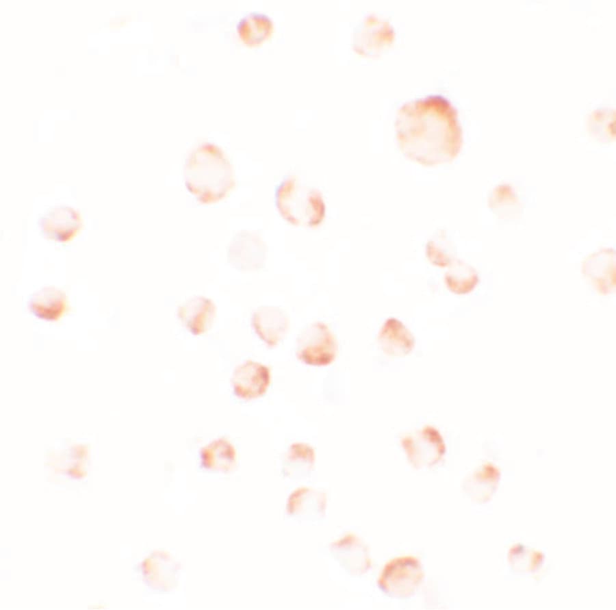 IHC-plus™ Polyclonal Rabbit anti-Human SCOP / PHLPP Antibody (IHC, IF, WB)