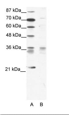 BARX1 Antibody (aa91-140, Biotin)