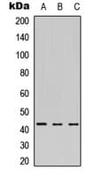 Polyclonal Rabbit anti-Human MEIS1 Antibody (Internal, WB)