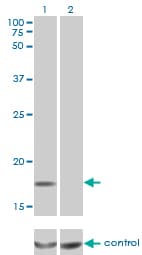 MCFD2 Antibody (clone 3A5-G4)