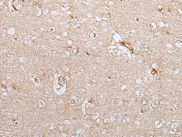 Polyclonal Rabbit anti-Human HOXC9 Antibody (IHC, WB)