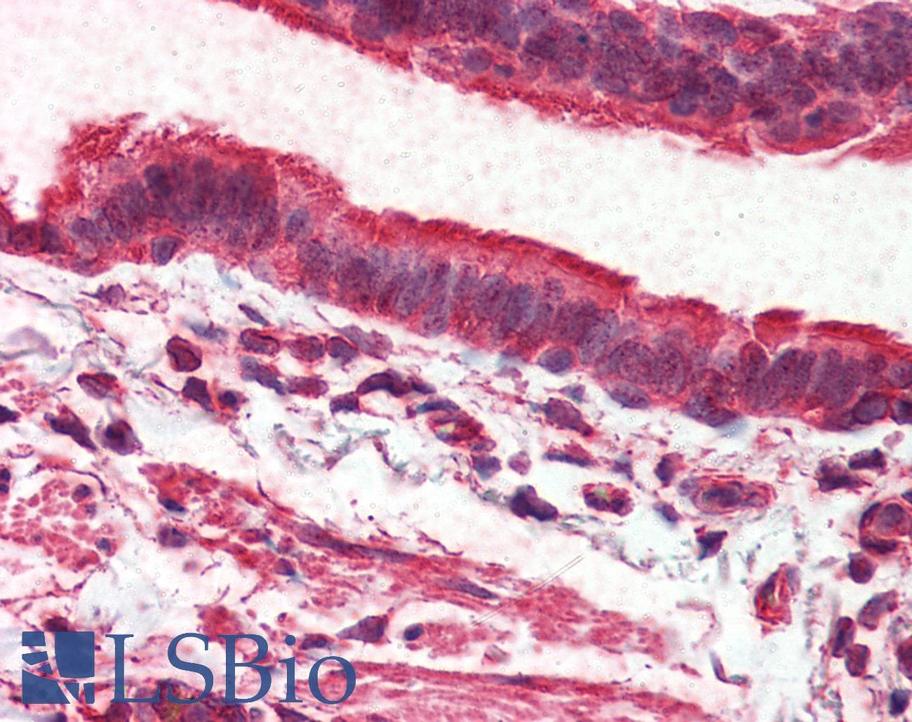 IHC-plus™ ADGRV1 / GPR98 Antibody (Internal)
