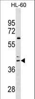 CCR4 Antibody (aa262-290)