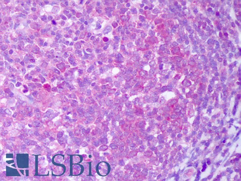 IHC-plus™ IL13 Antibody