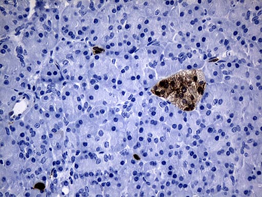 Monoclonal Mouse anti-Human GTPCH1 / GCH1 Antibody (clone OTI8C6, IHC, WB)