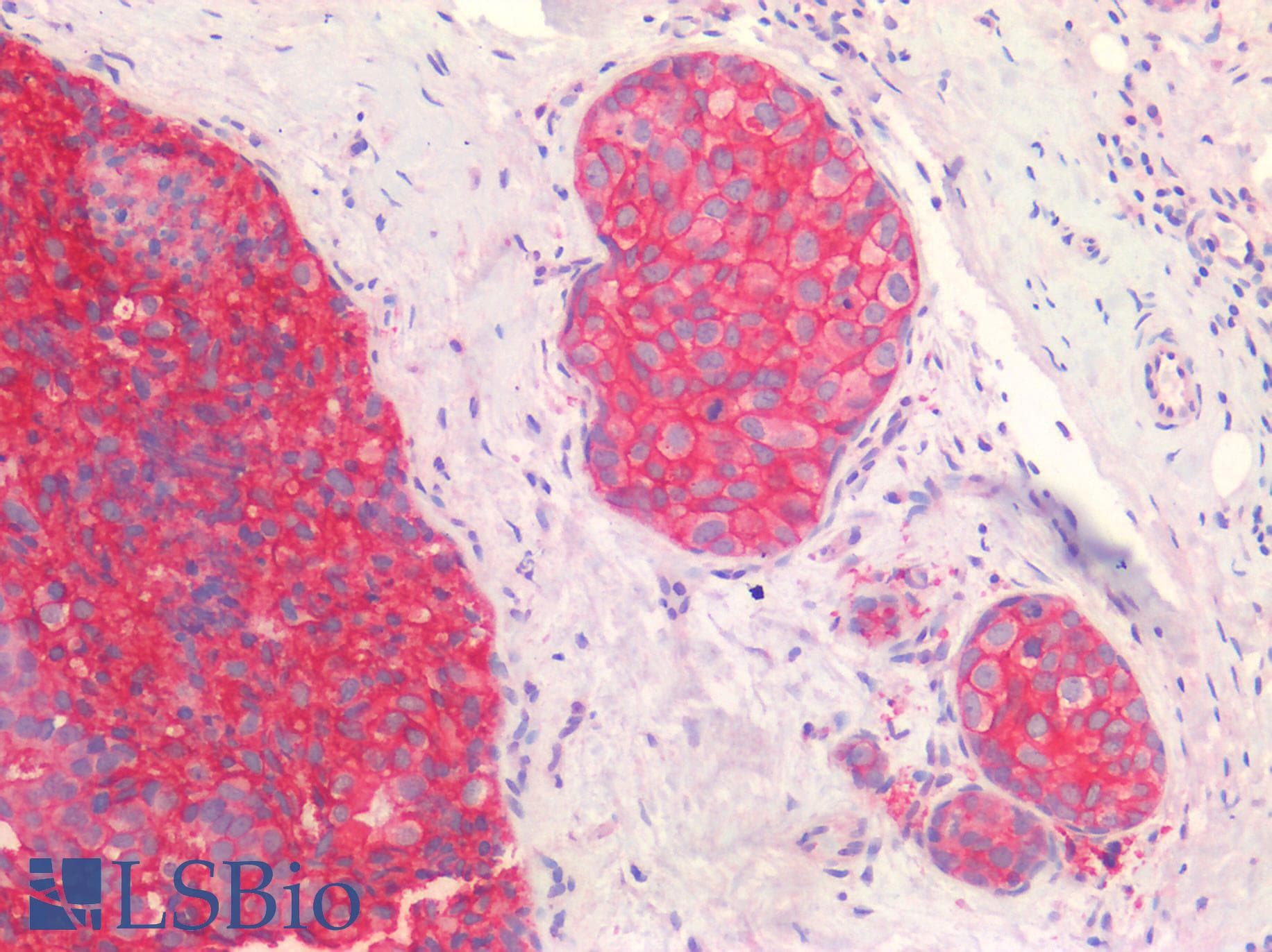 PathPlus™ Polyclonal Rabbit anti-Human ERBB2 / HER2 Antibody (IHC)