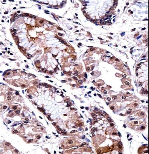 DLX5 Antibody (aa100-128)