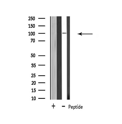 USP11 Antibody